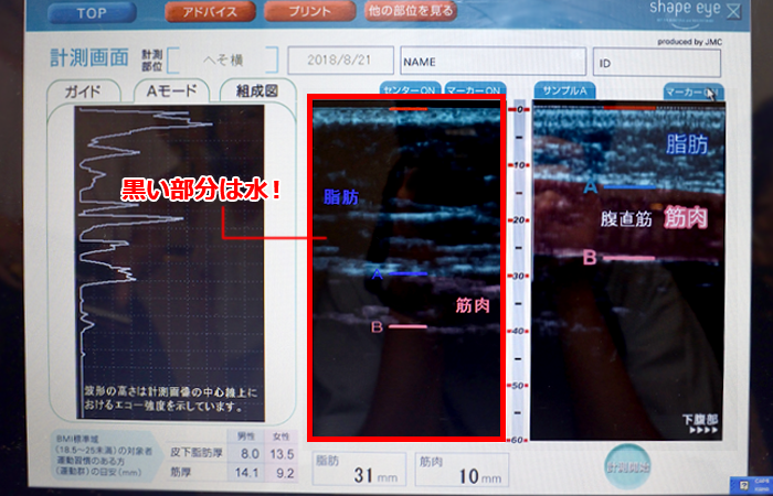 黒い部分は水!